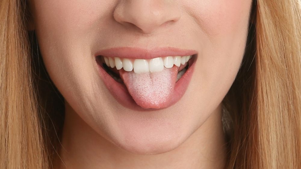 Oral Thrush Banner